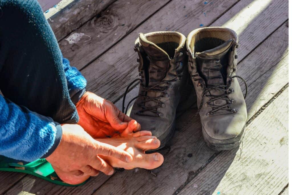 Blistered Foot While Hiking